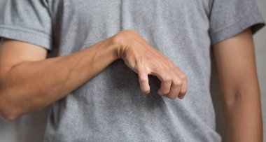 Volkmann contracture in left upper limb of Southeast Asian young man. It is a permanent shortening of forearm muscles that gives rise to a clawlike posture of the hand, fingers, and wrist.
