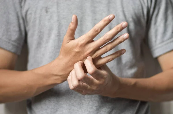 Asian Young Man Scratching His Hand Concept Itchy Skin Diseases — Stock Photo, Image