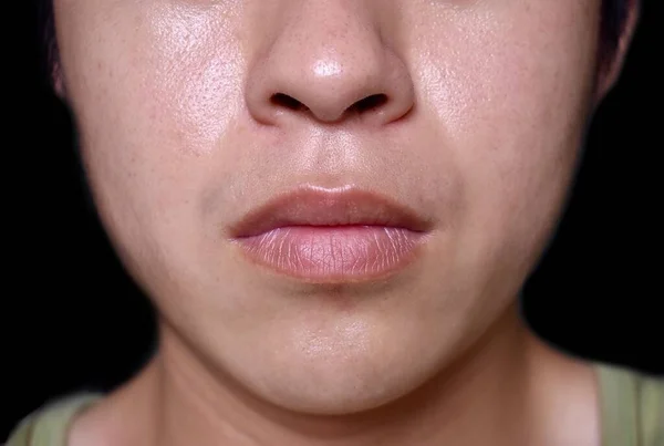 Oily Face Southeast Asian Myanmar Korean Adult Young Man — Fotografia de Stock