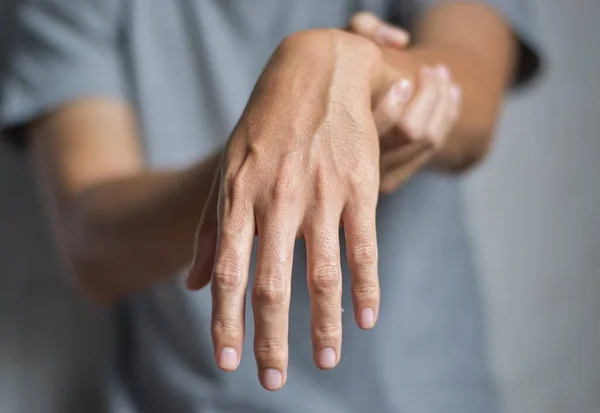 Radial Nerve Injury Wrist Drop Asian Myanmar Man — Stock Photo, Image