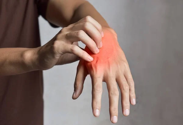 Asiatischer Junger Mann Kratzt Sich Der Hand Konzept Juckender Hauterkrankungen — Stockfoto