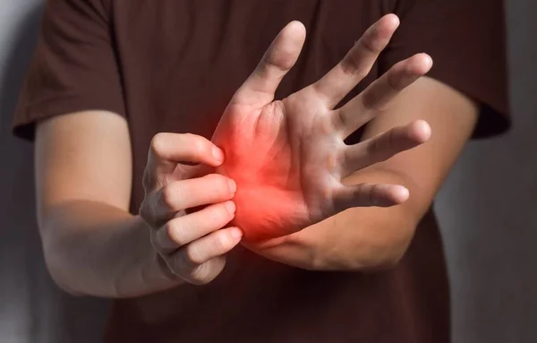 Asian Young Man Scratching His Hand Concept Itchy Skin Diseases — Stock Photo, Image