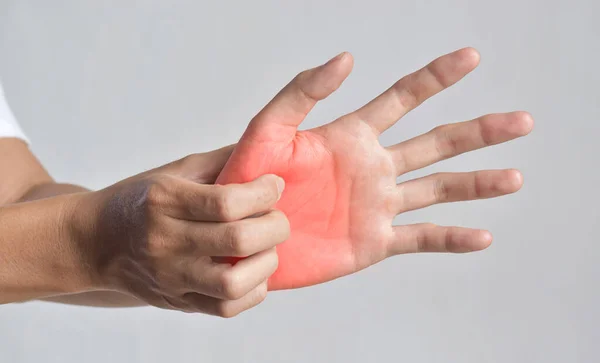 Asiatischer Junger Mann Kratzt Sich Der Hand Konzept Juckender Hauterkrankungen — Stockfoto