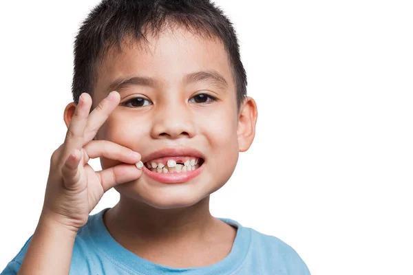 close up boy kid with opened mouth pointing at missing front baby tooth with finger smiling excitedly in on white background First teeth changing Going to dentist to do tooth treatment