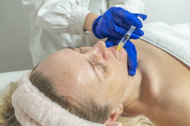 Güzellik iğnesi. Kozmetik kliniğinde kadınların cilt bakımı prosedürü. Eldivenli ve şırıngalı bir kozmetolojistin elleri.