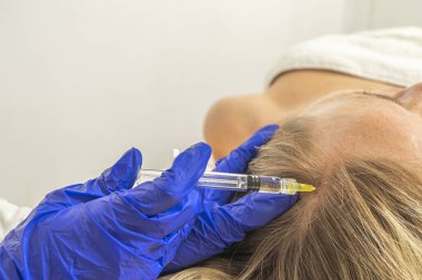 Mezoterapi prosedürü. Bir kozmetik uzmanı bir kadının kafasında mezoterapi prosedürü uygular. Saçları güçlendiriyor ve uzuyor..
