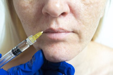 Güzellik kliniğinde mezoterapi. Kozmetikler kadının yüzüne enjekte edilir..