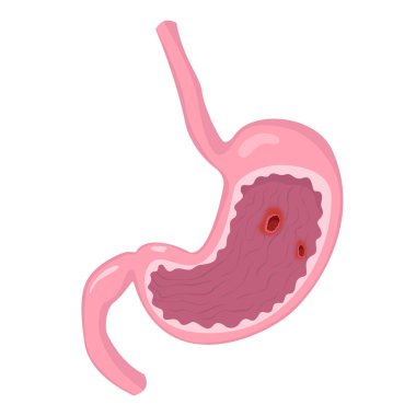 Atlas, ders kitabı ya da çalışma materyali için insan anatomisi çizimi. Çizgi film tarzında sağlıklı bir mide. Vektör illüstrasyonu