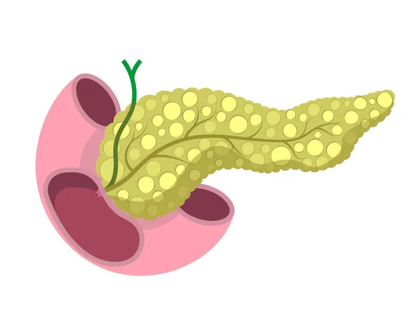 Anatomia Del Pancreas Complesso Con Intestino Dotto Biliare Illustrazione Organi — Vettoriale Stock