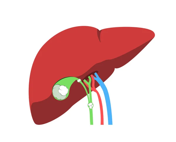 Medical Illustration Liver Gallbladder Bile Ducts Blood Vessels Entering Organ — 图库矢量图片