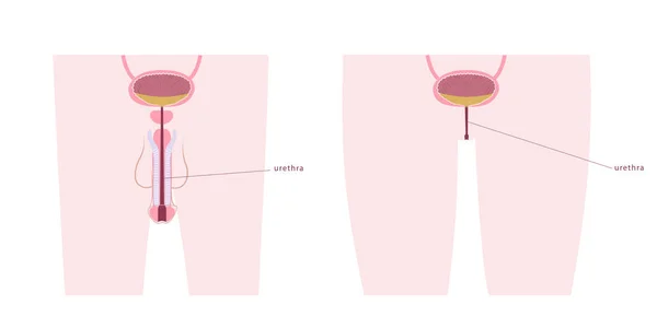 Diagrama Comparativo Uretra Masculina Femenina Anatomía Vesical Silueta Masculina Femenina — Archivo Imágenes Vectoriales