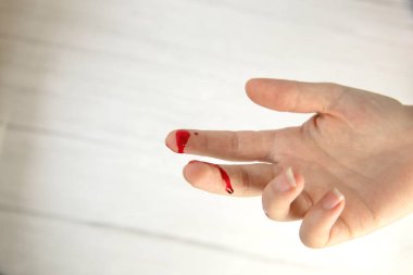 Kan ile el yaralanması, kan yarası üst görünüm, kopyalama alanı, tıbbi konsept metinler için boşluk gerektiriyor