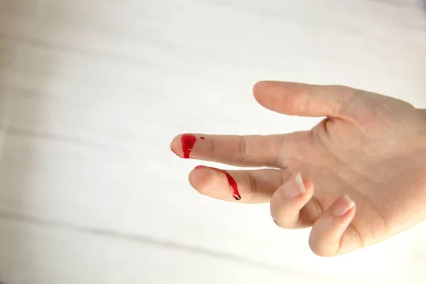 Hand Injury Blood Blood Wound Cut Top View Copy Space — Stock Photo, Image