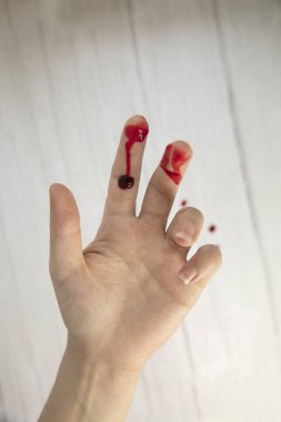 Kan ile el yaralanması, kan yarası üst görünüm, kopyalama alanı, tıbbi konsept metinler için boşluk gerektiriyor