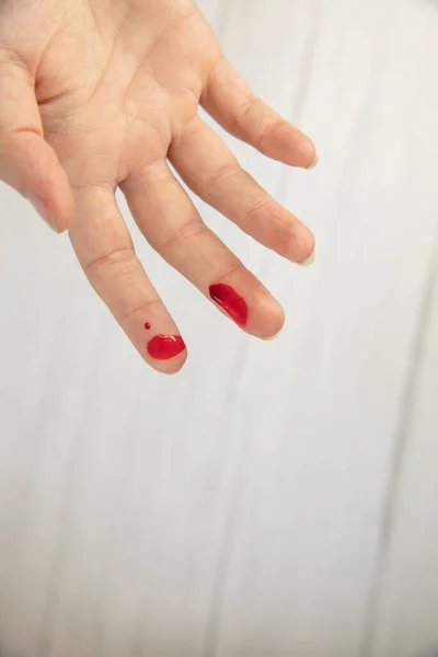 Luka Tangan Dengan Darah Luka Darah Luka Memotong Atas Melihat — Stok Foto