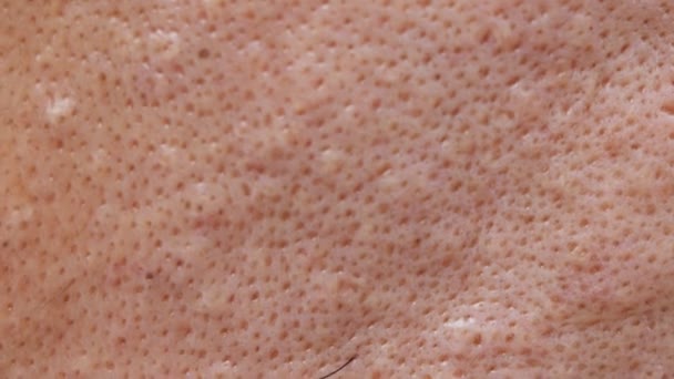 Chemikalien Können Ihrer Haut Schaden Weil Sie Keine Schutzkleidung Und — Stockvideo