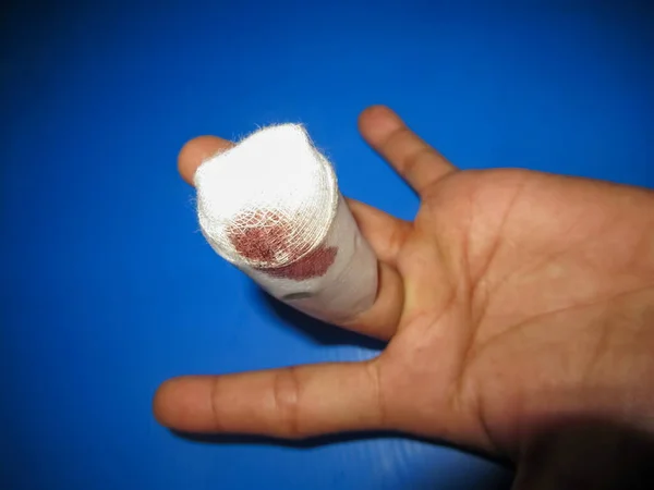 Wet Wound Fingers Red Blood Top Finger — Stock Photo, Image