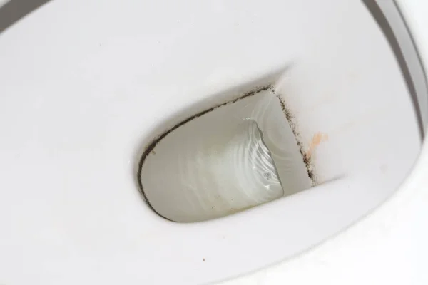 Tuvalet Kâseleri Lekeler Temizlenecek Tuvaletin Temizliği Sağlanacak — Stok fotoğraf