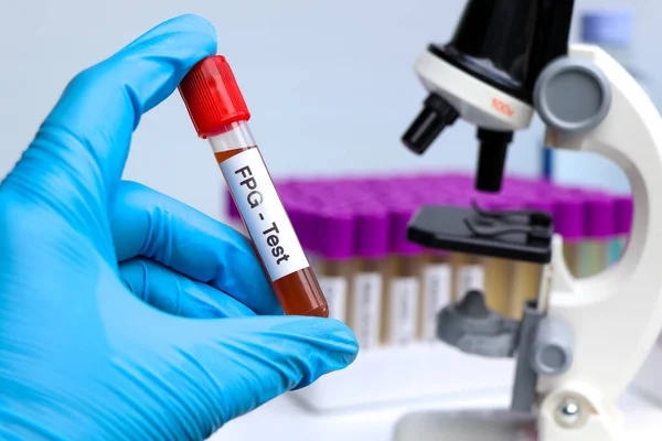 Fpg Test Blood Blood Samples Analyzed Laboratory Red Blood Test — Foto de Stock