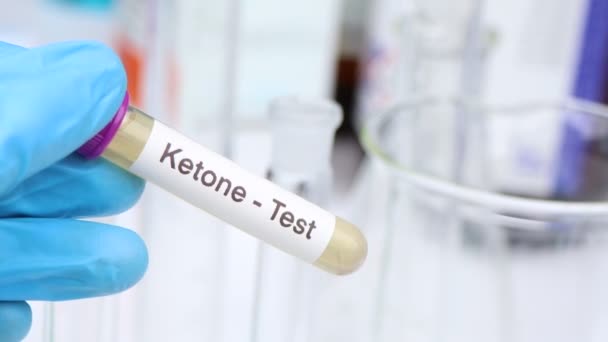 Próbki Moczu Badania Ketonów Laboratorium Próbka Moczu Probówce — Wideo stockowe