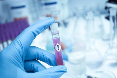 Camdaki kimyasallar, laboratuvardaki kimyasallar ve endüstrideki kimyasallar analizde kullanılan kimyasallar.