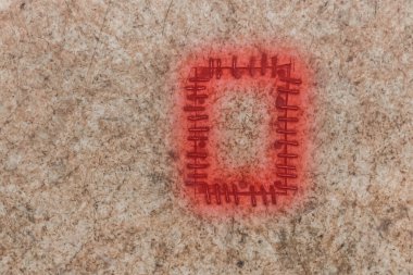 Dikkatsizce dikilmiş eski malzemeler, aşınma ve onarım.