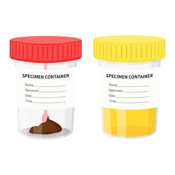 Two Plastic Jars Samples Urine Stools Medical Laboratory Tests Illustration — Stock Vector