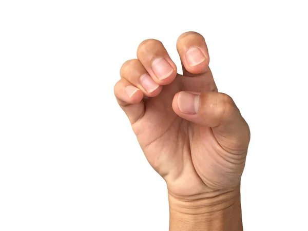 有不健康指甲的亚洲男人的手 — 图库照片