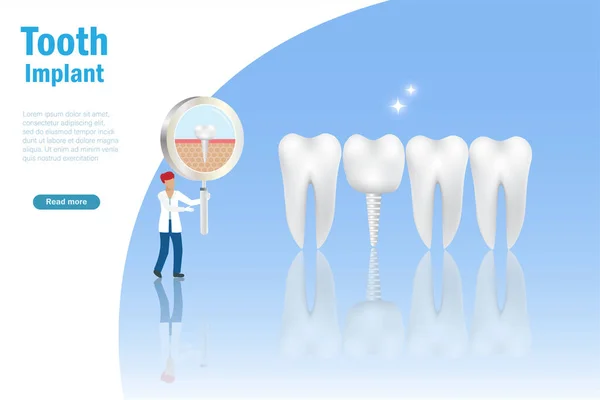Dental Tooth Implant Stomatology Oral Medicine Care Concept Dentist Doctor — Stockvector