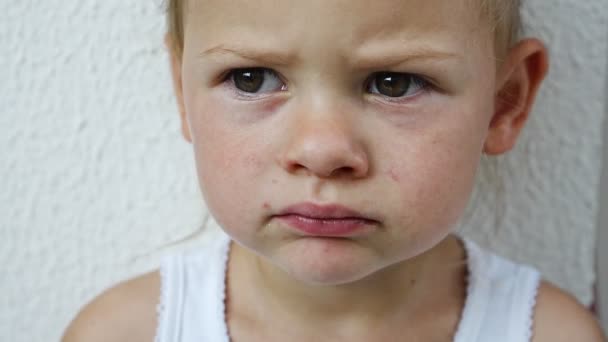Enterovirus Leg Lengan Mulut Rash Pada Tubuh Seorang Anak Virus — Stok Video