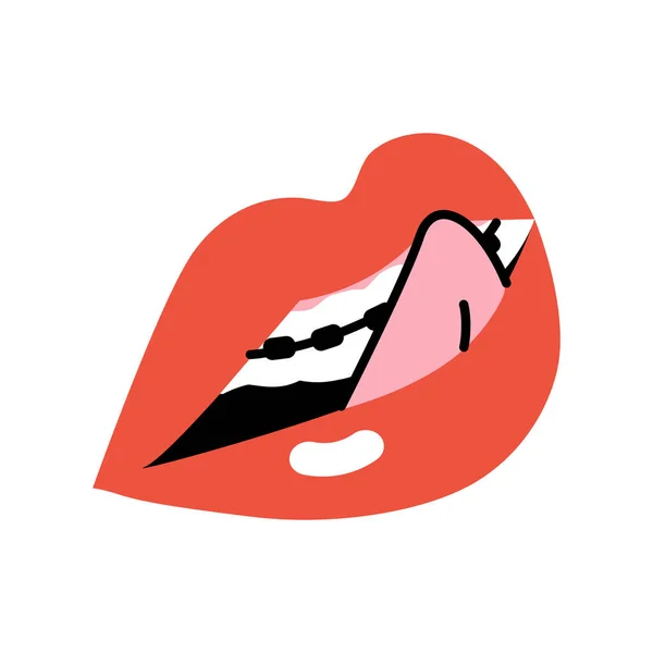 Female Lips Bright Red Lipstick Braces Concept Women Movement Stylized — 스톡 벡터