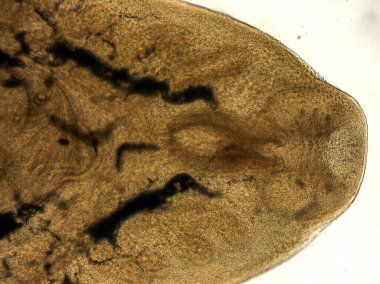 Beyinciğin çapraz kesiti. Hafif mikrograf. 