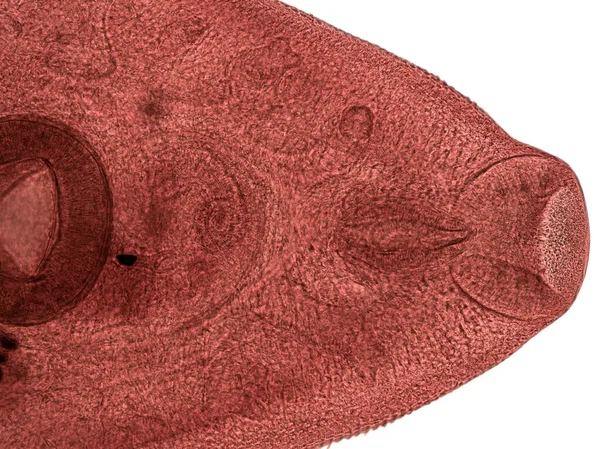 Vermes Parasitas Humanos Fígado Fasciola Hepatica Estágio Adulto Microscópio Luz — Fotografia de Stock