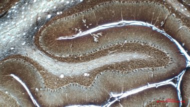 Beyincik üç katmana ayrılır. Dipte granül hücreleriyle dolu kalın tanecikler var. Ortasında Purkinje tabakası var. Gümüş nitrat hamile bırakıldı..