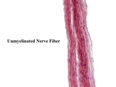 An interesting photo taken with a microscope. Unmyelinated fibers in peripheral nerves. Longitudinal section. Hematoxylin and Eosin Stainit.  clipart