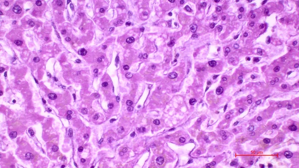 Light micrograph of a human liver stained with hematoxylin and eosin. The hepatocytes are arranged in cords separated by clear areas where hepatic sinusoids showing red blood cells are located.