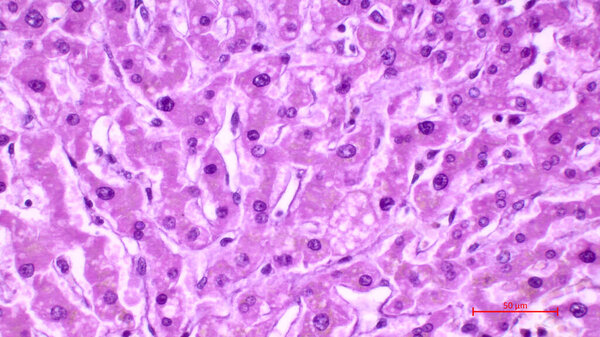Light micrograph of a human liver stained with hematoxylin and eosin. The hepatocytes are arranged in cords separated by clear areas where hepatic sinusoids showing red blood cells are located.