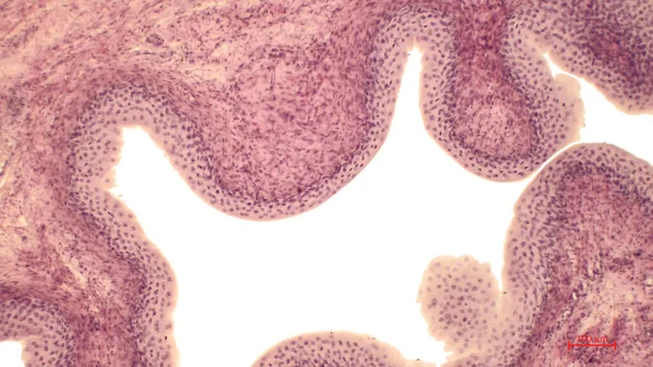 Microscopia Ușoară Căptușelii Interne Vezicii Urinare Țesutul Este Epiteliu Tranzitoriu — Fotografie, imagine de stoc