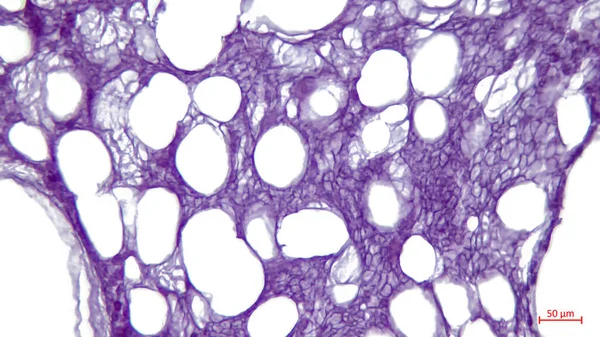 Легка Мікроскопія Біла Жирова Тканина Трубчастої Кістки Великі Яскраві Дірки — стокове фото