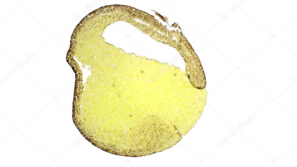 Frog development.  Medium gastrula stage. The frog been used as a model organism for the study of gastrulation. Van Gieson's stain. Magnification: x40. 