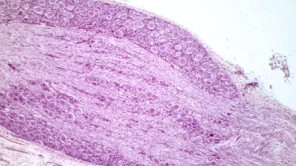Ganglio Radice Dorsale Neuroni Pseudounipolari Ganglio Radice Dorsale Ematosslyn Macchie — Foto Stock
