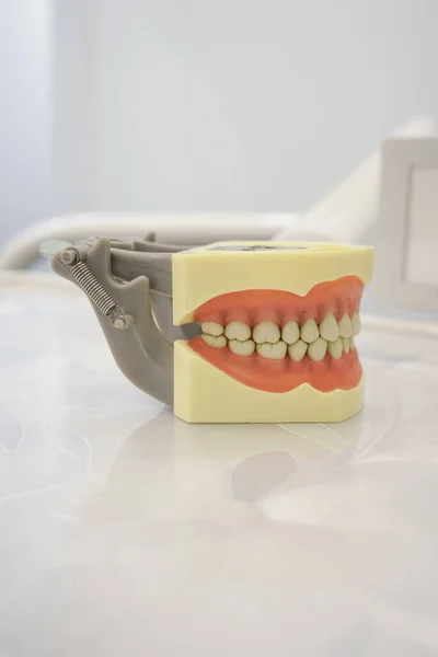 医学教材 带细节的塑料假牙 咬合和微笑设计 工作室里的物品 — 图库照片