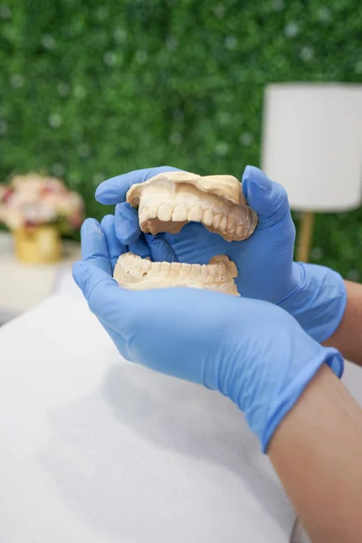 Ręka Rękawiczkami Chirurgicznymi Modelingiem Protezy Szczękowej Zdrowie Zębów Projekt Uśmiechu — Zdjęcie stockowe