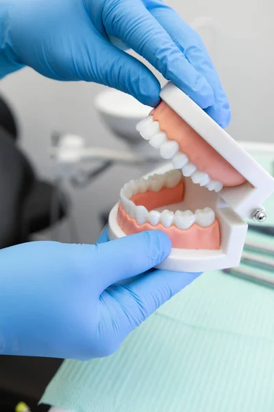 Didactic Material Gloved Hand Showing Artificial Prosthesis Detail Teeth Gums — Zdjęcie stockowe