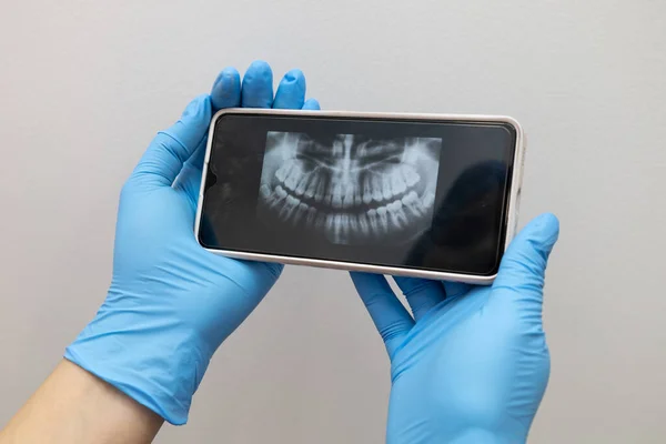 Ray Examination Results Mobile Device Person Mouth Examining Dental Treatment — Zdjęcie stockowe