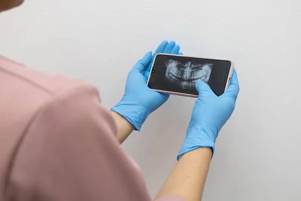 Showing Ray Examination Results Mobile Device Person Mouth Examining Dental — ストック写真