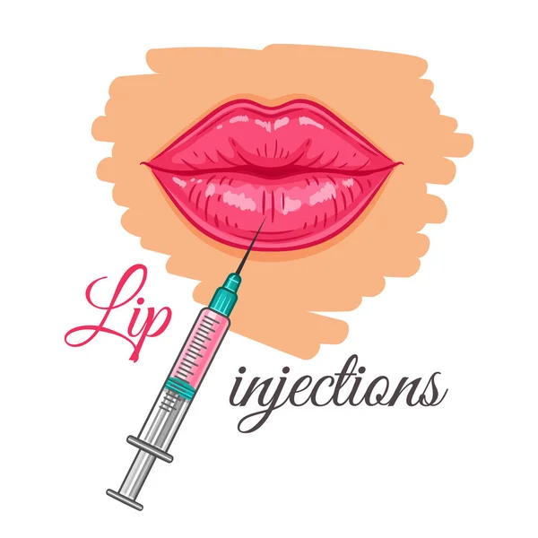 Lip Syringe Injection Augmentation Hyaluronic Acid Filler Sign Medical Beauty — Stock Vector