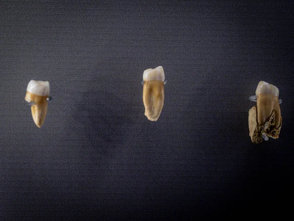 Dientes Homo Neanderthalensis 000 Cueva Axlor Dima Muzeum Arkeologiczne Museo — Zdjęcie stockowe