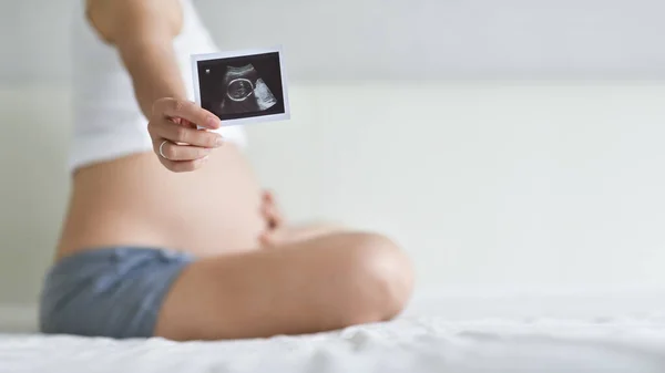 Asiatisk Gravid Kvinna Sitter Visar Ultraljud Skanna Bild Sängen — Stockfoto