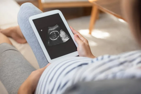 Female Waiting Her Baby Asian Pregnant Woman Looking Her Ultrasound — Fotografia de Stock